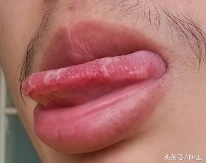 中医学:身体好不好看舌头