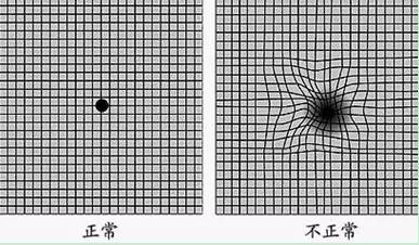 眼病自测,自己看看有啥眼病!