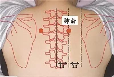 寒气入肺，反复咳嗽，必须灸之 ！ .艾灸养生