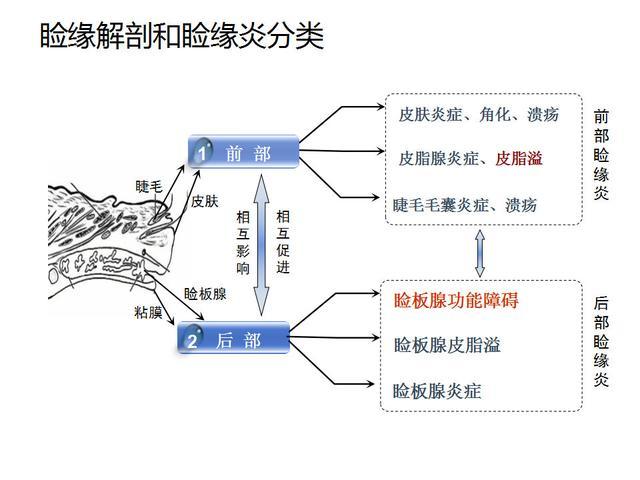 眼睑缘炎的原因及治疗