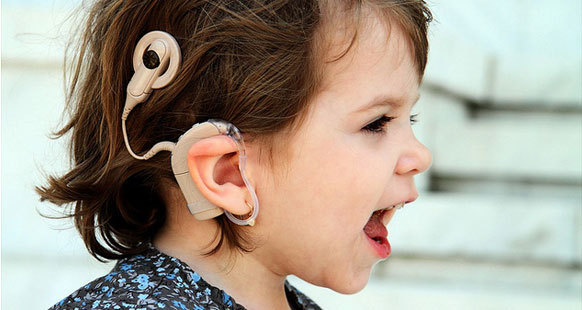 人工耳蜗言语处理器多少钱多少年一换?