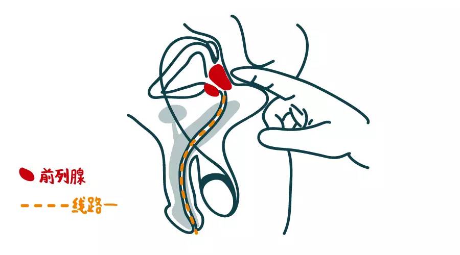 如何保养前列腺,令全世界男人头疼的难题