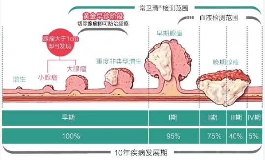 那么,腺瘤性息肉大概多久会转变为结直肠癌?