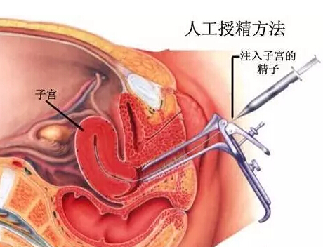 人口授精_人口普查(2)