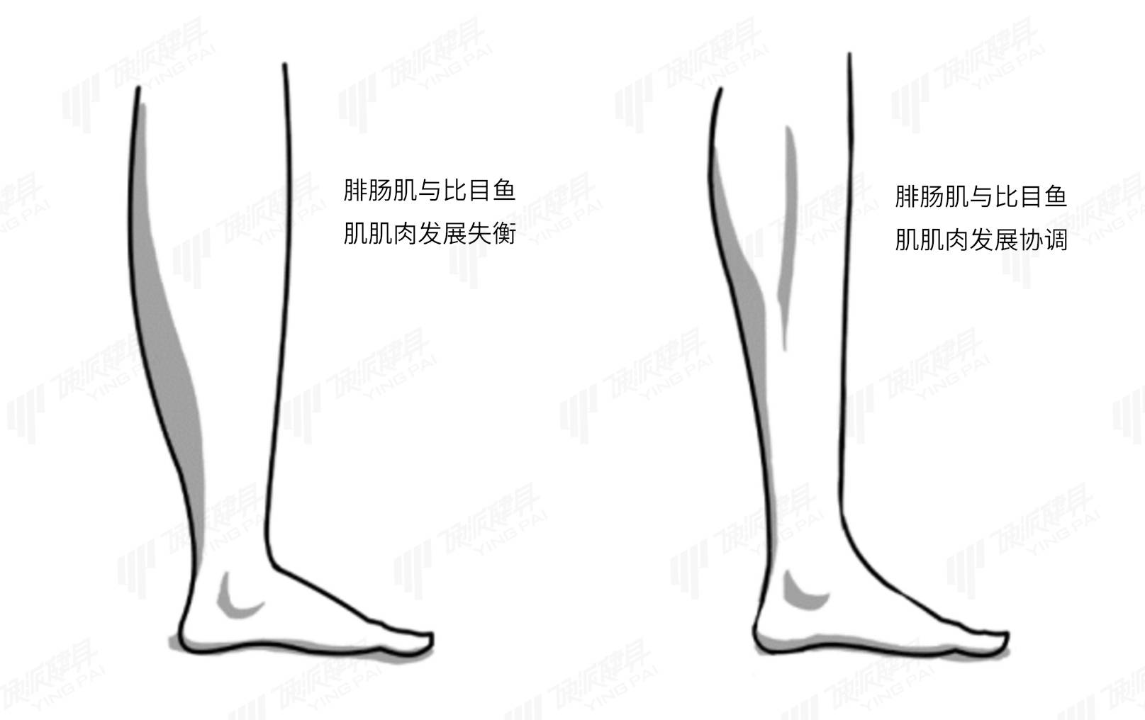 3/正确瘦腿,怎么做?