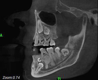 当临床工作中有了中科天悦口腔CT,会有什么不