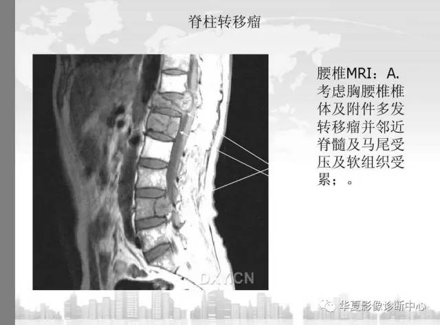 来源:华夏影像诊断中心 投稿邮箱:gk@yxj.org.