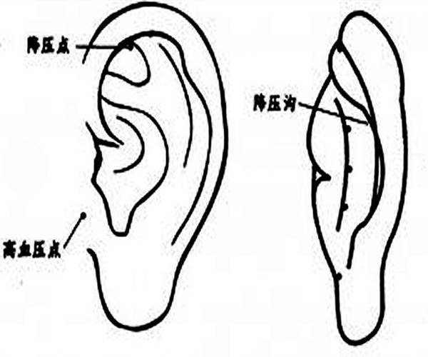 耳朵穴位 按摩耳内侧降压沟,自己估测血压:把手指按在耳内侧降压沟上