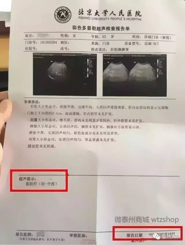 【推荐】swisse护肝片实测报告:三年肝硬化治疗全追踪