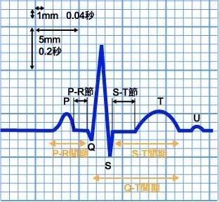 了解这些波形及其所代表的意义,是教你怎么看心电图的第二步.