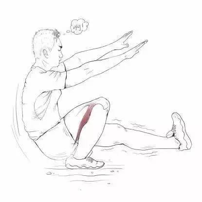 贝壳式 4)下蹲时向后倒/前腿伸不直 大腿后群腘绳肌紧张引起,跑步时