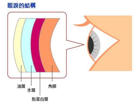 干眼症惹上身:欲哭"无泪",究竟为哪般?