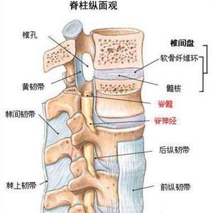 腰椎间盘突出压迫神经导致小腿酸胀怎么办?