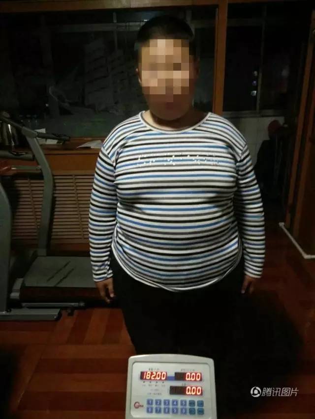 辽宁10岁男孩182斤坐睡3年,珍爱生命远离肥胖!