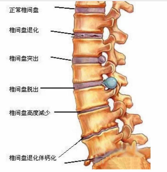 脖子痛怎么办可以缓解疼痛