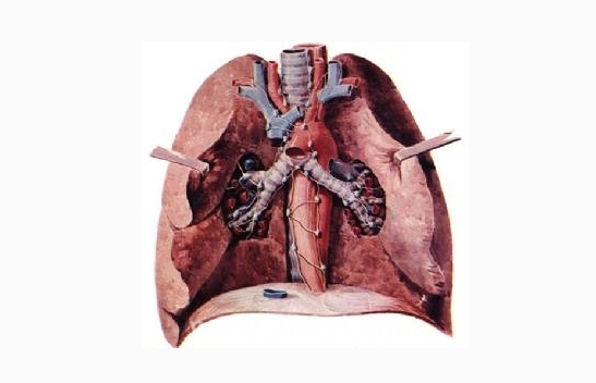 小细胞肺癌经综合治疗后,能治愈的4个经典病例