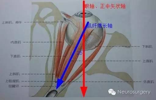 会让眼球呈现下列圆圈位置:此时眼球饶冠状轴向上,饶垂直轴向内,饶矢