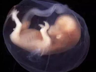罗女士连续两次妊娠发生 "严重胎儿生长受限",宝宝在27周左右胎死宫