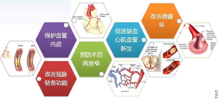 pci术后再发心绞痛如何防治?| 冠心病名家访谈(二)