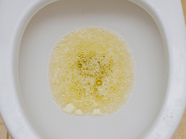 小便可看出前列腺健康 尿后有泡是前列腺不好