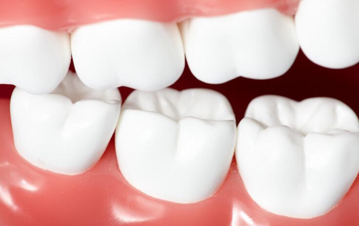 牙齿保健的五个常规错误!