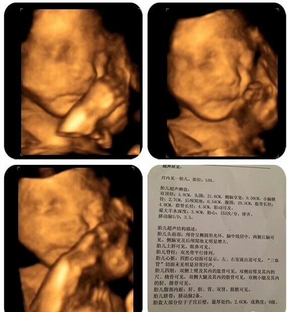 孕25周去拍了四维的相片和胎儿心脏超声检查,产检必做项目之一哦!