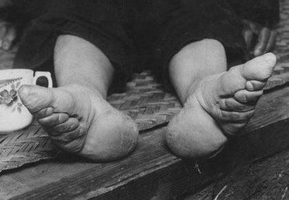 裹脚,裹脚即缠足,是一种古代女性习俗,指把女子的脚用长布条紧紧缠住
