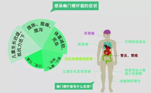 国内外专家共识称:幽门螺杆菌须根除治疗!