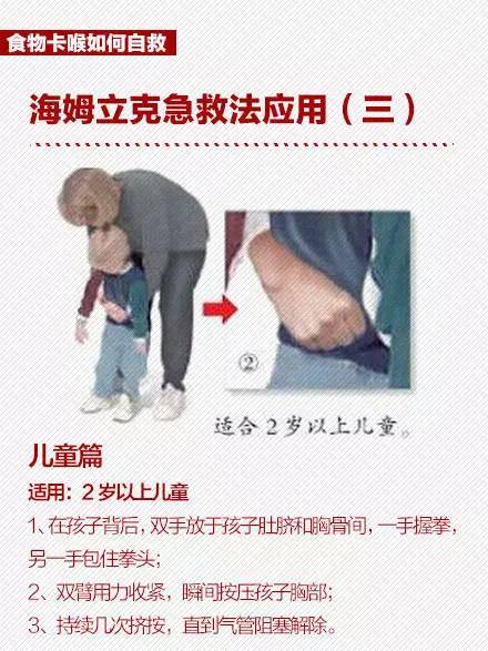 吃东西噎到怎么办?"海姆立克急救法"教你怎么急救!