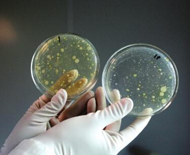 而且,菌落总数和致病菌有本质区别,菌落总数包括致病菌和有益菌,对