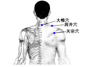 颈椎病按摩为何越按越痛