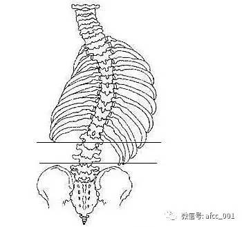 脊柱侧弯常见的问题有哪些?百度新闻