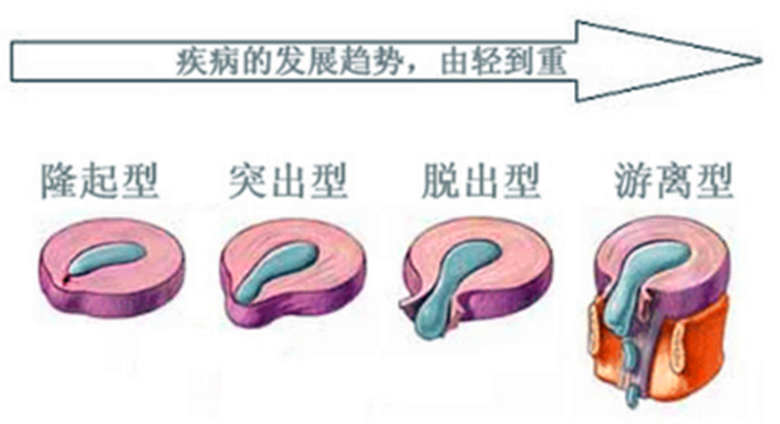 膀什么腰什么成语_牛膀是牛的什么(3)