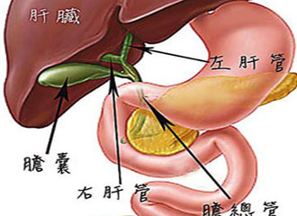 什么是急性胆囊炎