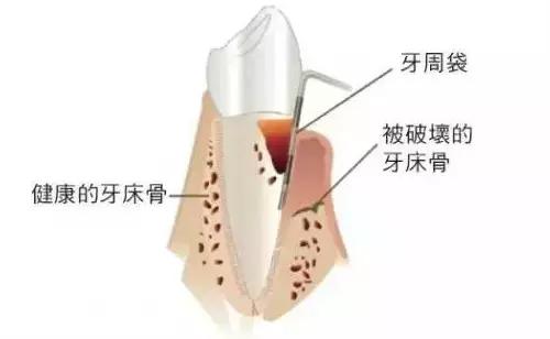 成人口水多是什么原因(3)