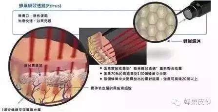 皮秒激光的原理和作用_皮秒激光切割玻璃的原理和工艺研究(2)