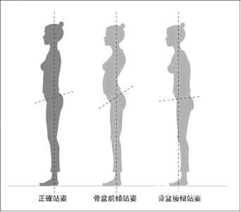 变美不难 ▏比起减肥瘦身"终生事业"矫正体态效果更快