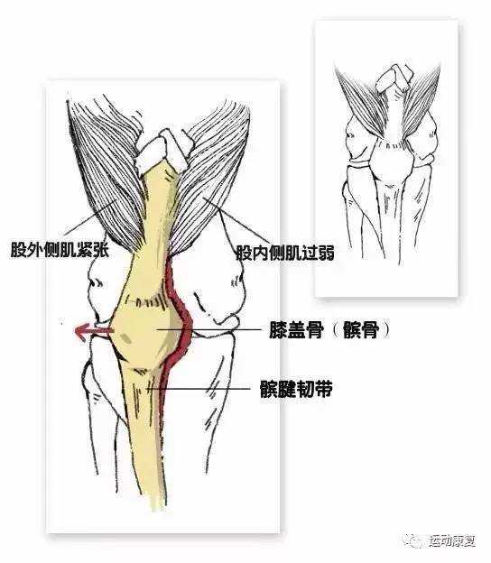 髌骨高清图