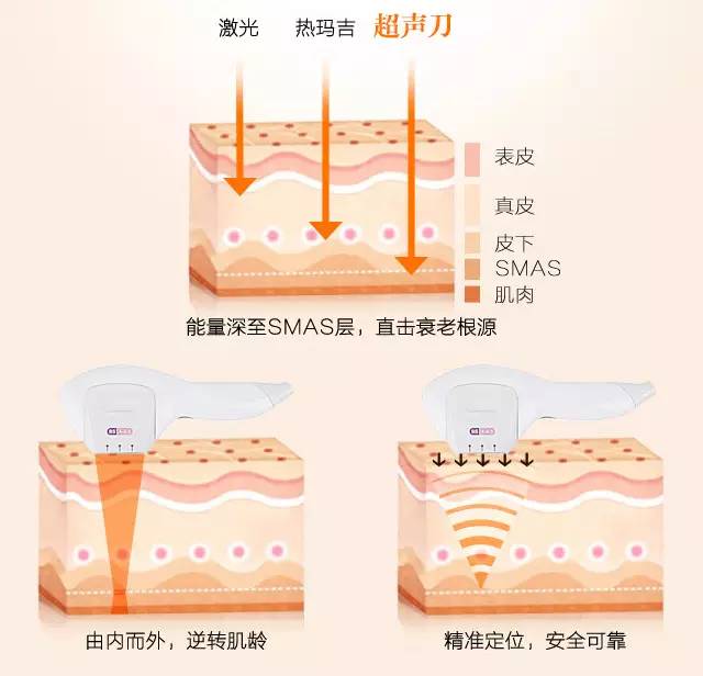 超声刀改善的问题