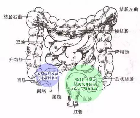 消化科普丨克罗恩病:诊疗之路,其修远兮