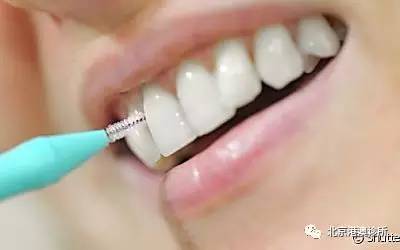牙刷的好帮手——牙线/牙缝刷