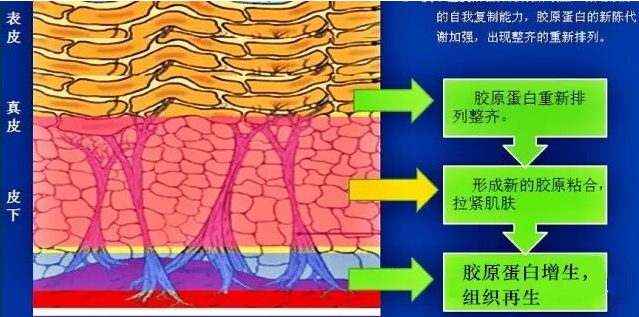 美容超声刀原理是什么_白带是什么图片(2)