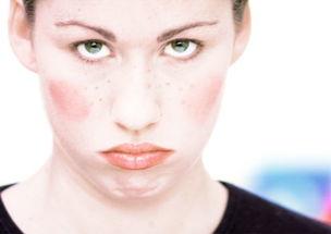 敏感肌肤激素脸常伴有红血丝是怎么回事?怎么