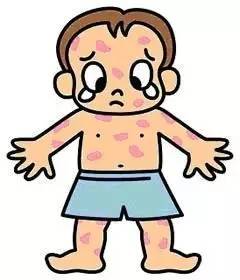 水痘以发热及成批出现周身性红色斑丘疹,疱疹,痂疹为特征.