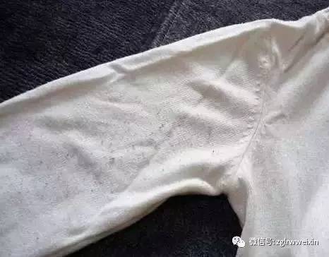 黑衣服上全是白毛毛怎么办