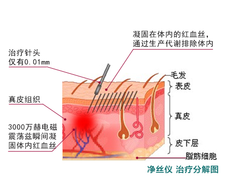 射频仪器的原理_3)从车载射频电子标签卡读取的信息,以及车型判别设备所采集到的数据均被送(2)