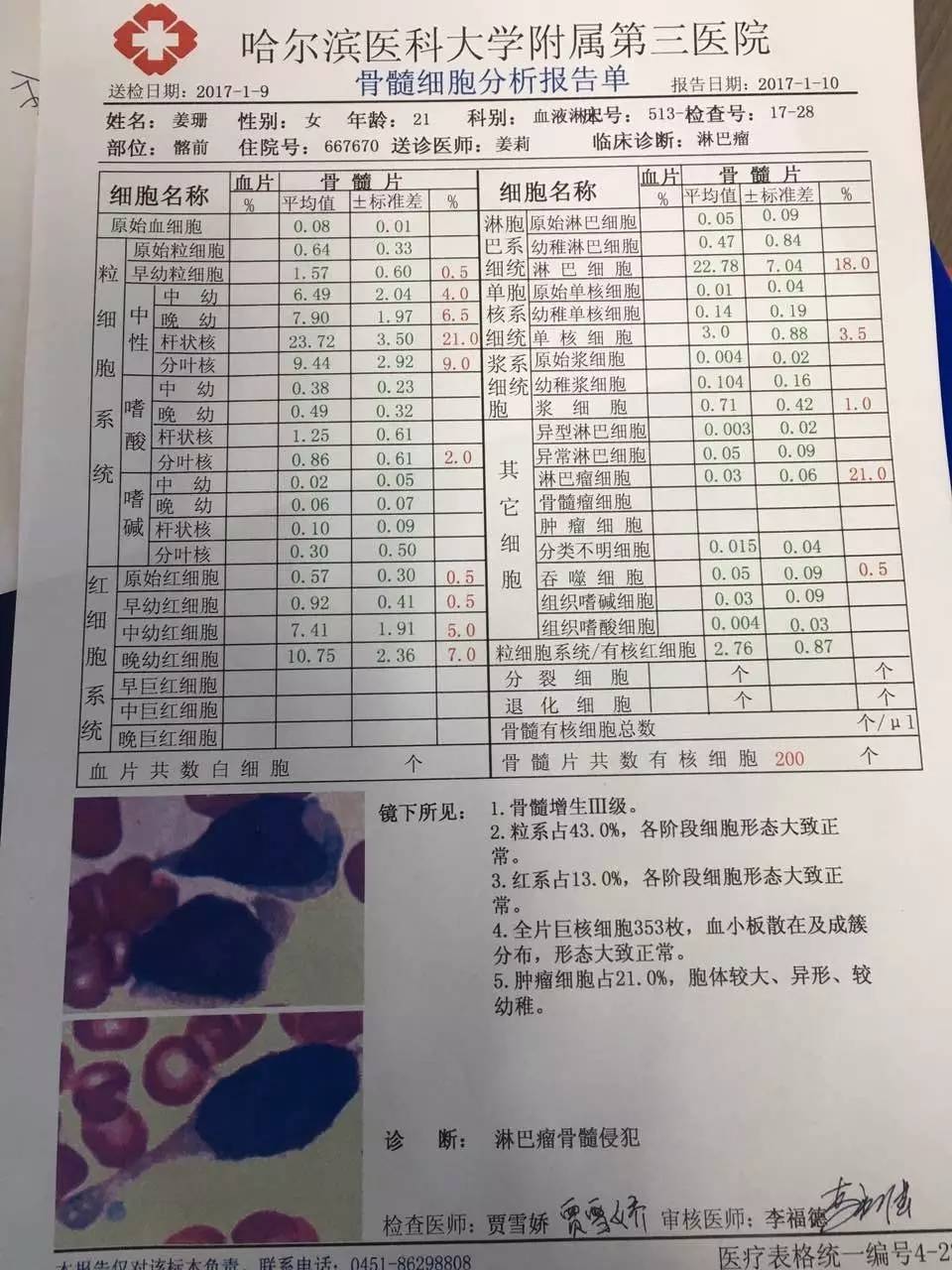 姓名:姜珊 地址:南岗区哈尔滨医科大学附属肿瘤医院 511病房3床 父亲