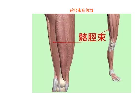 什么是髂胫束症候群