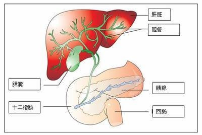 胆结石复发怎么办