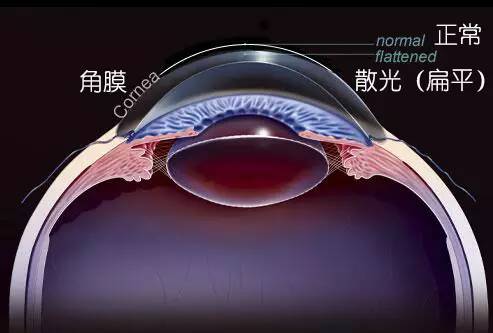 这15种常见眼科病,你了解的有哪些?